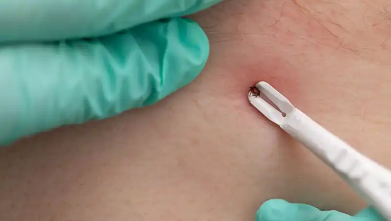 Kene Tehlikesine Dikkat! Uzmanlar Tüm Detayları Açıkladı